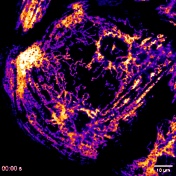 Animated fluorescence image of beating cardiomyocytes