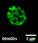 Time-lapse fluorescence image of focused yeast cells with a scale bar
