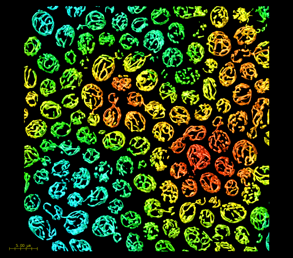 Yeast heterogeneity microscopy image